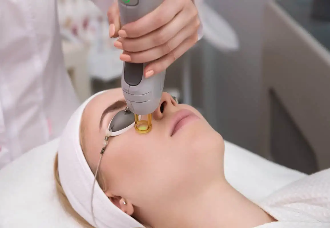 MOXI Laser Treatment by Elle Skin & Beauty Co in Florence KY