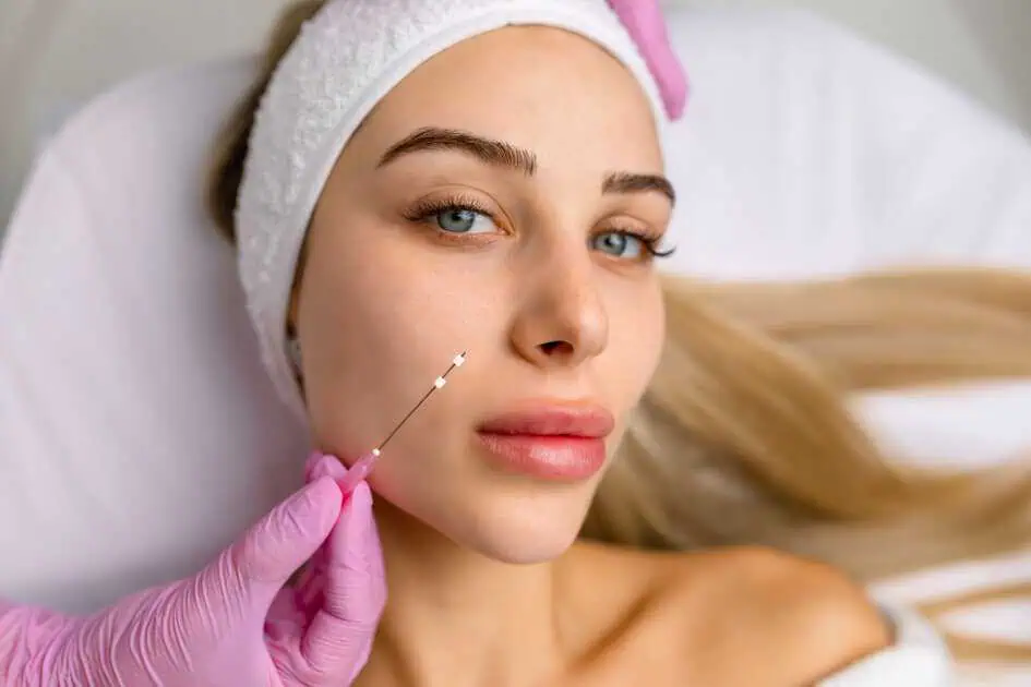 PDO Thread In Florence, KY by Elle Skin & Beauty Co