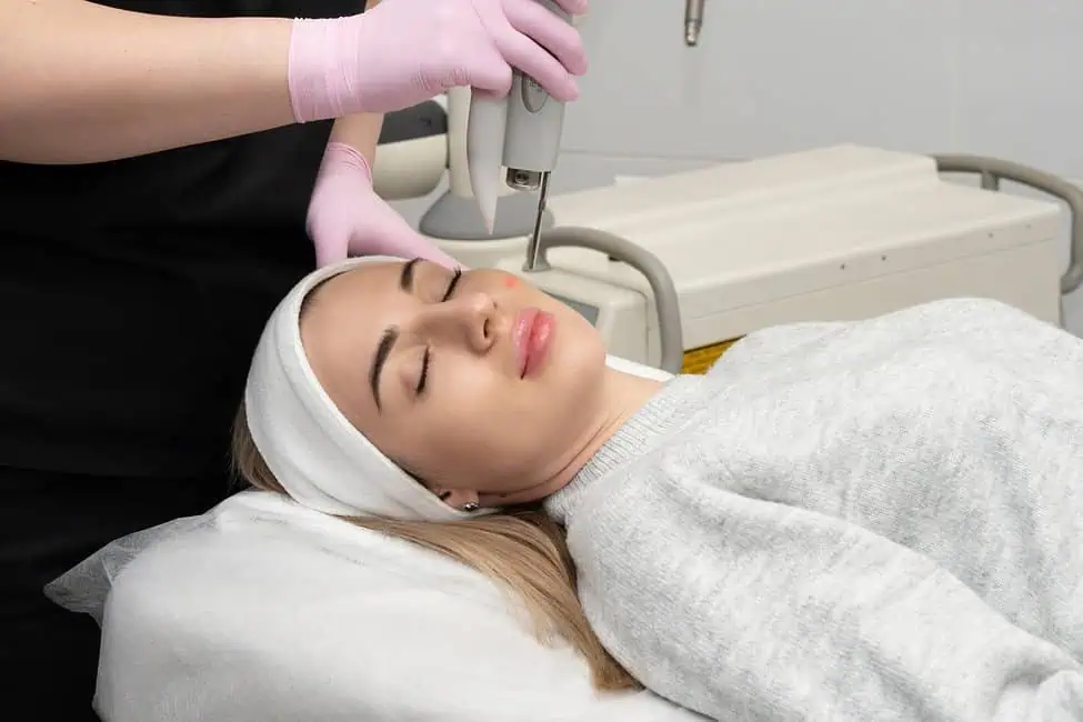 MicroLaser Peel by Elle Skin & Beauty CO in Florence, KY